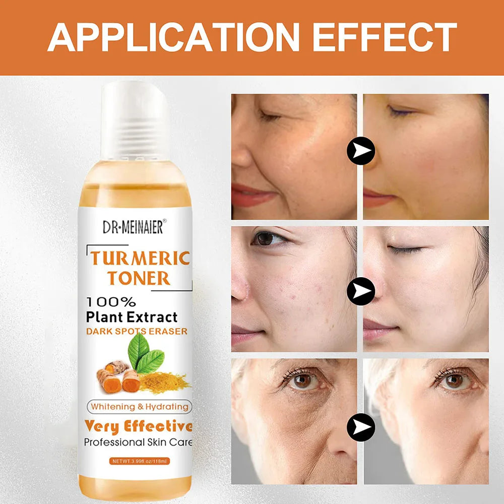 2pcs Turmeric Toner Brightening Face Serum Dark Corrector Moisturizing Vitamin C Ginger Essence Skin Lightener Cosmetics